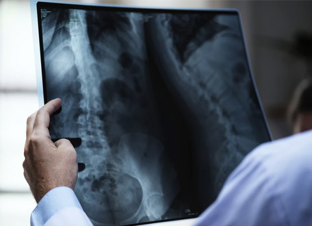 Attól tart, hogy megsérül?